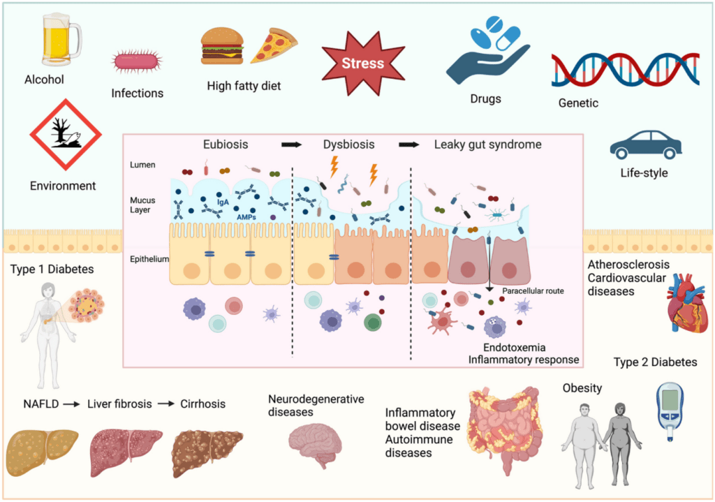 Leaky Gut 1